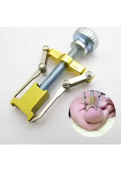 Ecoform Batık Tırnak Çıkartma Aparatı: Güvenilir ve Etkili Tırnak Tedavi Çözümü