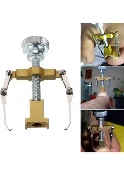 Greathings Profesyonel Batık Tırnak Düzeltme Aparatı ile Ayak Sağlığınızı Koruyun