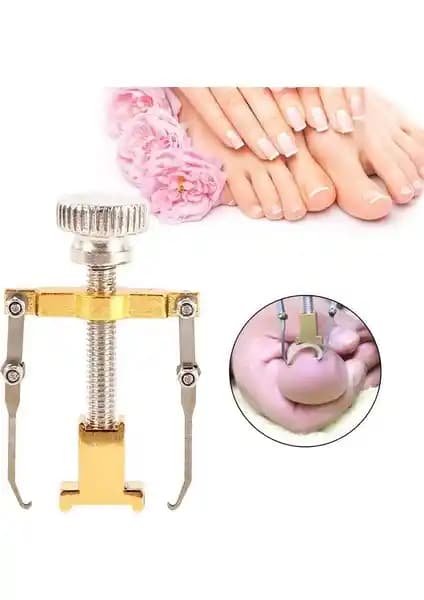 Tırnak Batması Çözümünde Nail Batık Batan Tırnak Sökme Aparatı: Kullanım ve Avantajlar