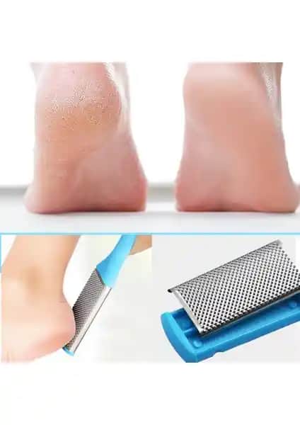 Xolo Çift Taraflı Ayak Topuk Rende Törpü XL69: Pratik ve Etkili Ayak Bakım Çözümü