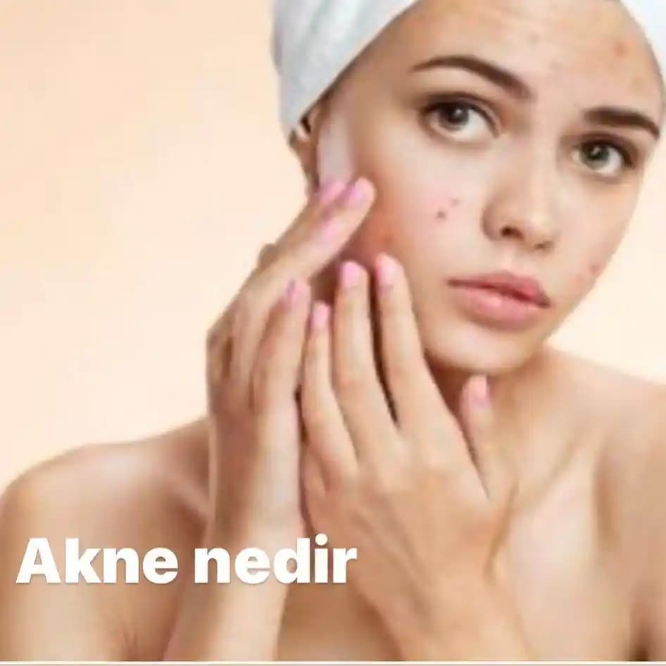 Akne ve Toplumdaki Yanlış Anlayışlar: Kişisel Sınırların ve Uzman Tedavisinin Önemi