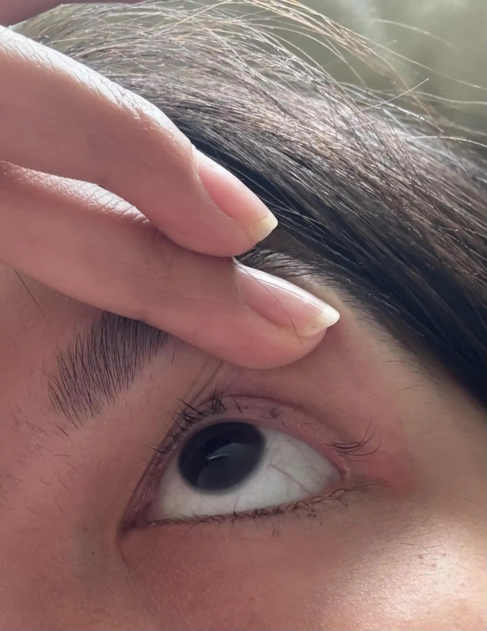 Düğünden Önce Kirpik Kopması: İyileşme Süreci ve Etkili Bakım Yöntemleri