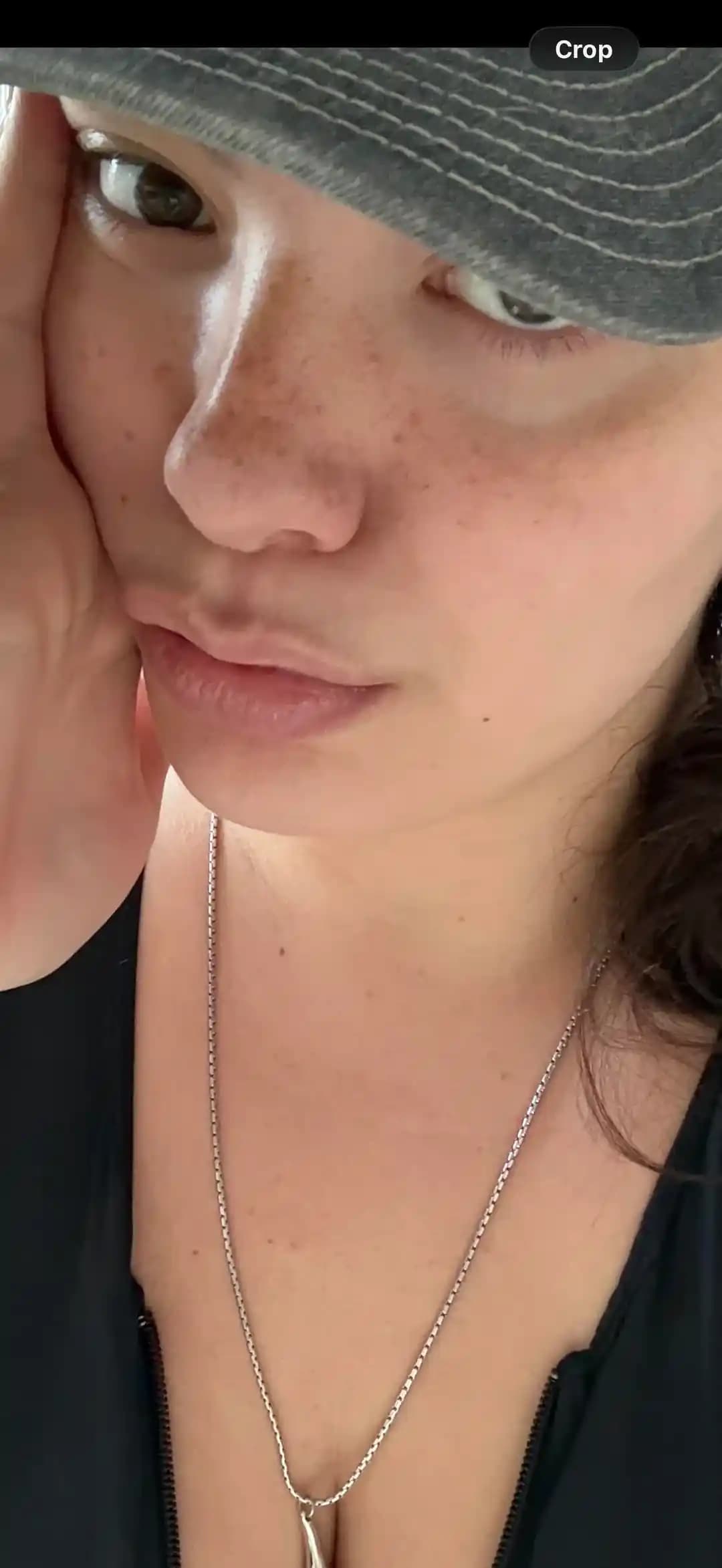 Göz Altı Morlukları: Genetik Nedenler, Bakım Yöntemleri ve Makyaj Teknikleri