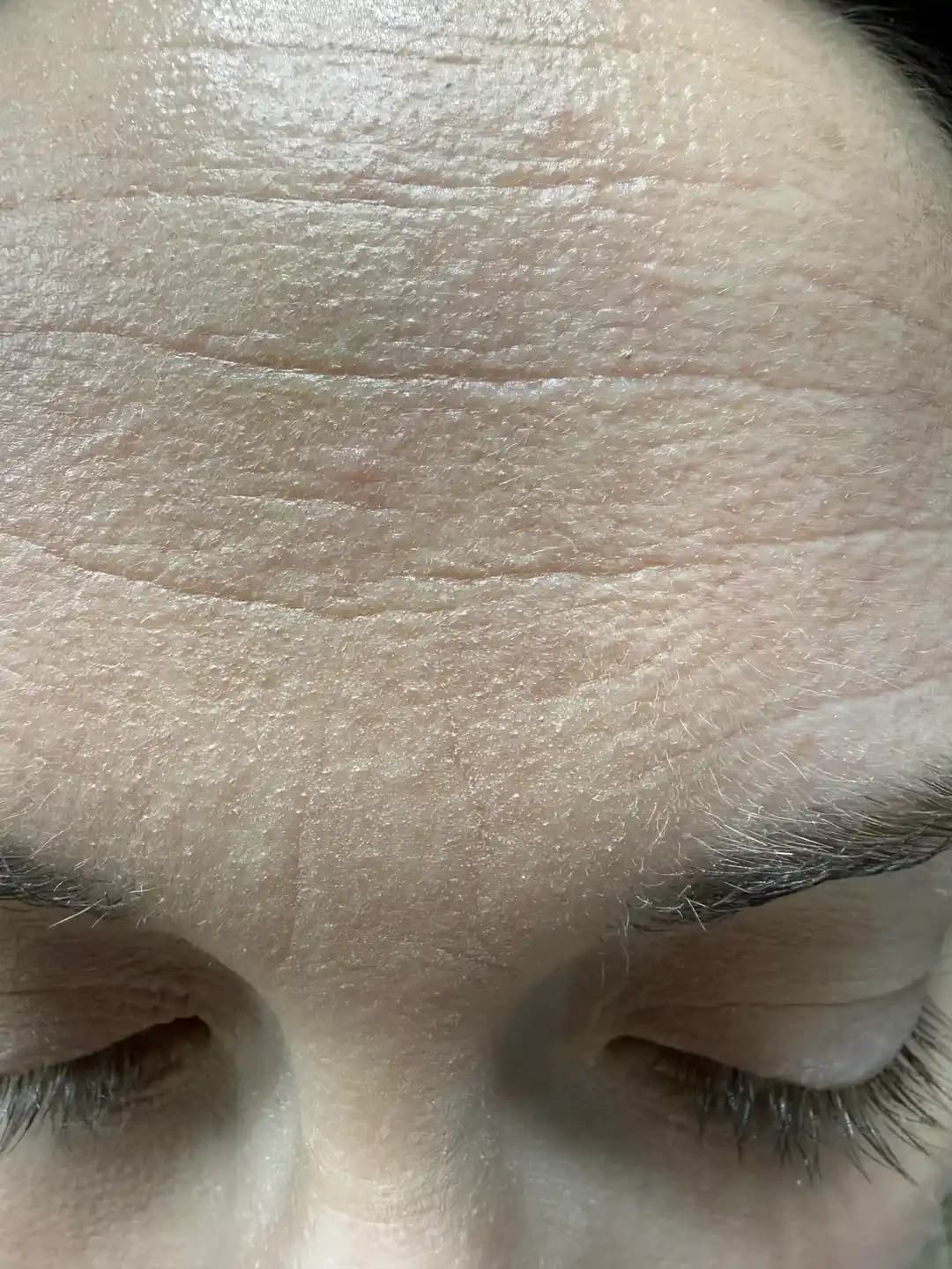 Kuru Ciltlerde Makyaj Problemleri ve Çözüm Yöntemleri: hEDS ve Cilt Bariyeri