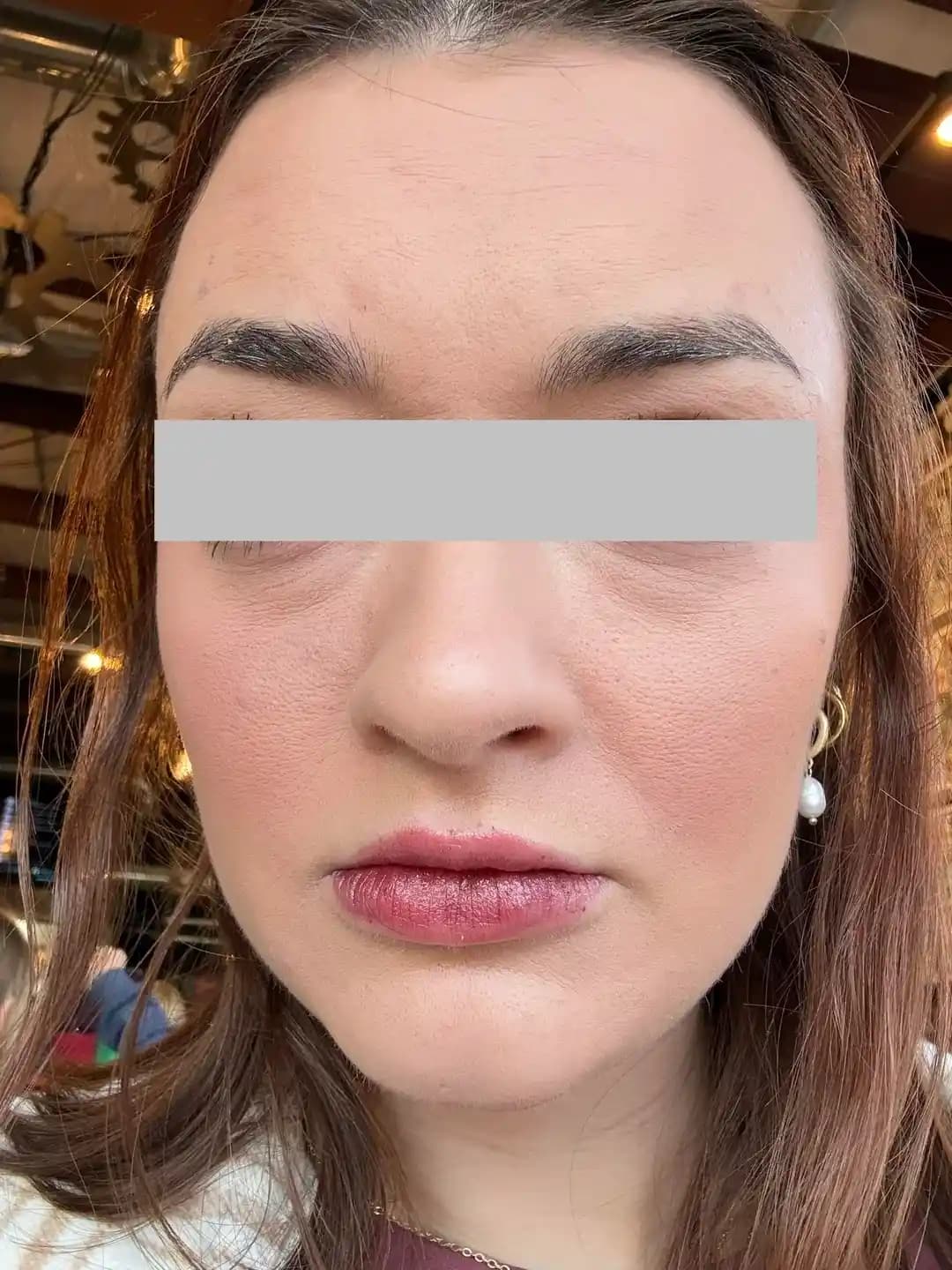 Yetişkinlerde Akne ve Makyaj Problemleri: Doğru Ürün Seçimi ve Cilt Bakımı Yöntemleri