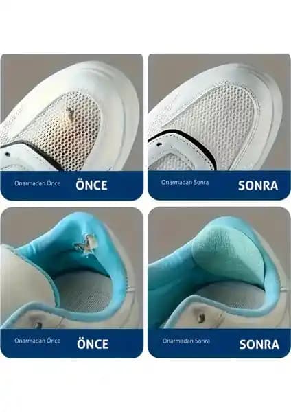 Fixall Yapışkanlı Keçe Tamir Yaması ile Ayakkabı ve Topuk Onarımı Kolaylığı