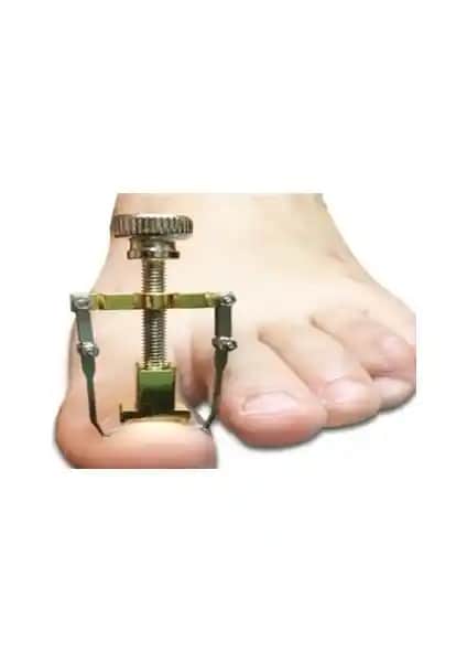 Magic Gift Batık Tırnak Çıkartıcı Aparat ile Güvenli ve Etkili Tırnak Tedavisi