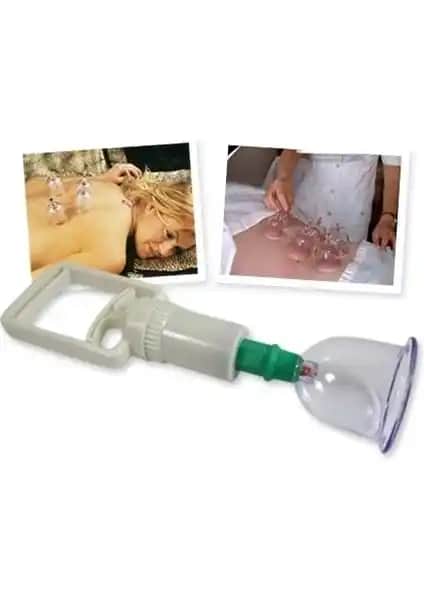 Ozcmax Vakumlu Kupa Ç-Ekme Seti ile Geleneksel Tedavi Modern Çözümlerle Buluşuyor