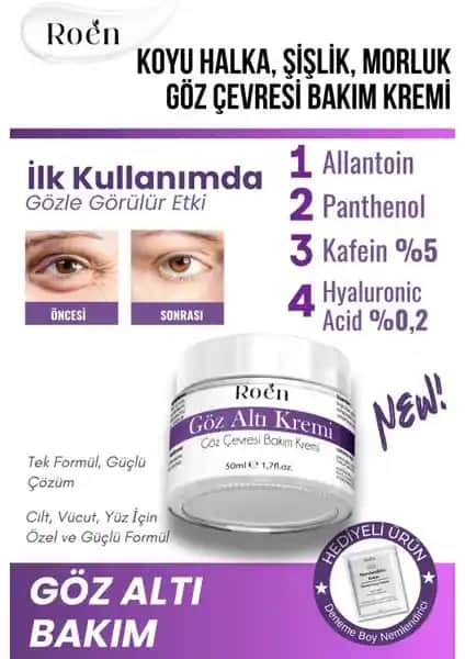 Roen Göz Altı Bakım Kremi: Morluklar ve Şişliklere Karşı Etkili Çözüm