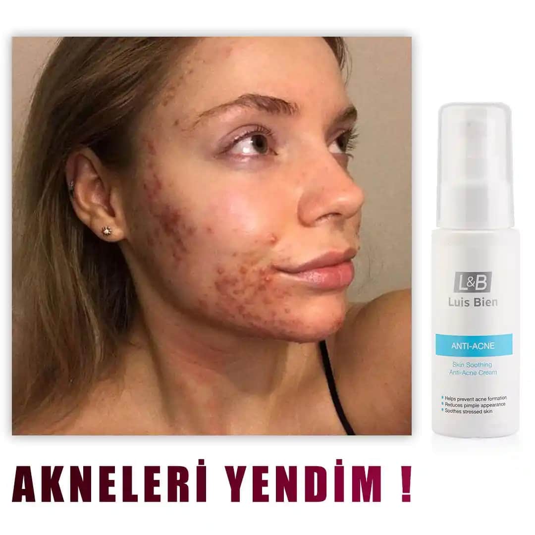 B3 Vitamini İçeren Kremler: Cilt Sağlığını Güçlendiren Etkili Bakım Ürünleri