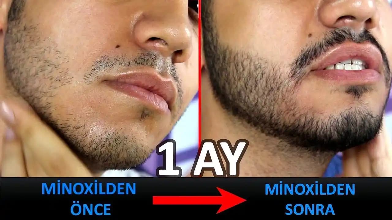 1 Aylık Sakal Bakımı ve Stil Rehberi Erkekler İçin Kapsamlı Bilgi