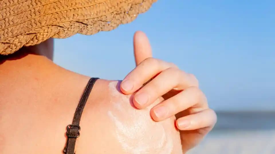 1. Derece Güneş Yanığına İyi Gelen Yöntemler ve Korunma İpuçları