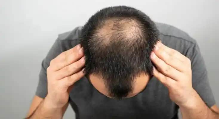 Adana'da Saç Ekimi Fiyatları ve Kaliteyi Dengede Tutmanın Yolları