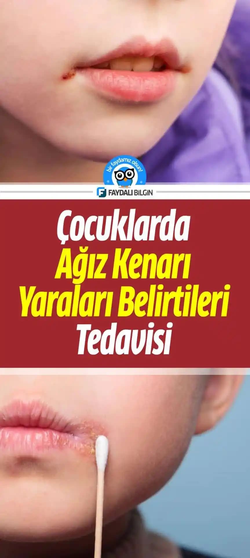 Ağız Kenarı Kararmalarının Nedenleri ve Etkili Çözüm Yöntemleri