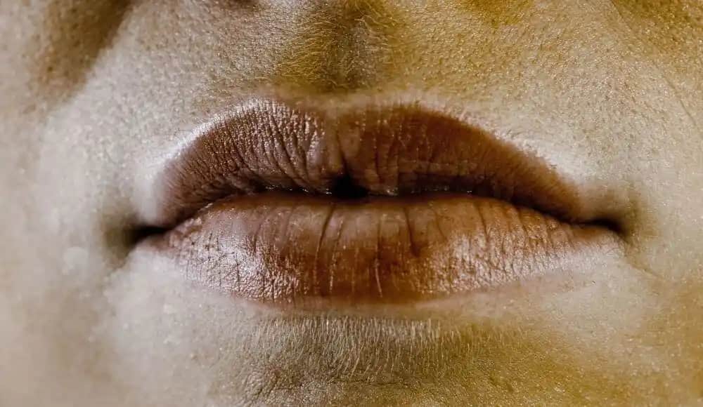 Ağız Kenarlarında Kararma Nedenleri ve Etkili Çözüm Yöntemleri