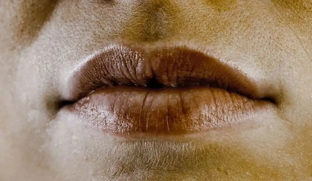 Ağız Kenarlarında Kararma Nedenleri ve Etkili Çözüm Yöntemleri