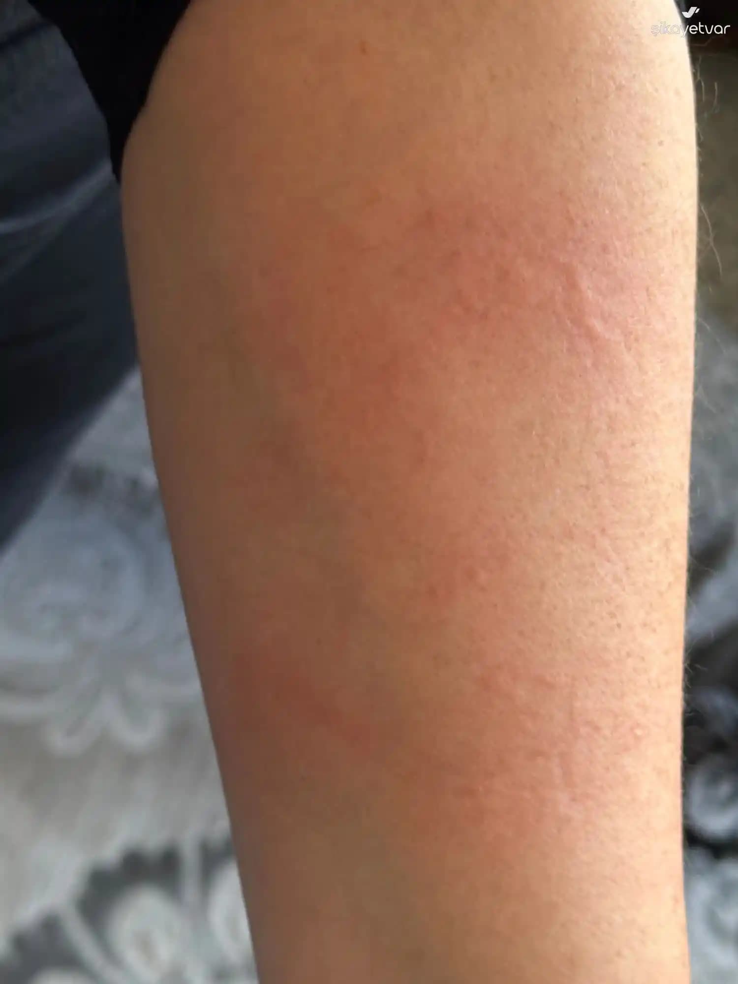 Alerji Yapmayan Parfüm Markaları ve Cilt Dostu Güvenilir Seçenekler