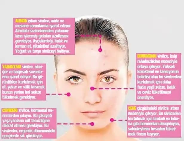 Alında Çıkan Sivilceler: Nedenleri, Etkileri ve Etkili Çözüm Yolları