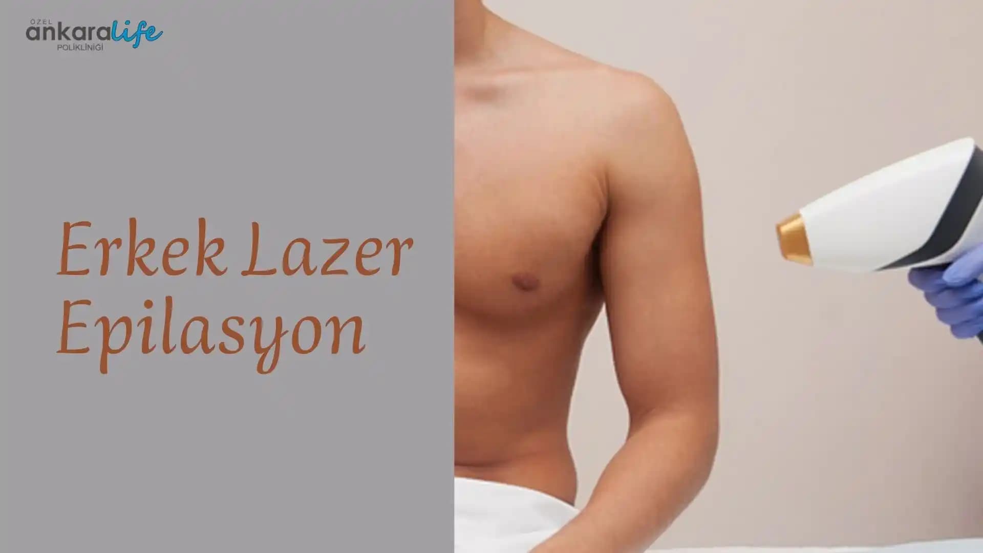 Ankara'da Erkekler İçin Güvenli ve Etkili Epilasyon Yöntemleri Rehberi