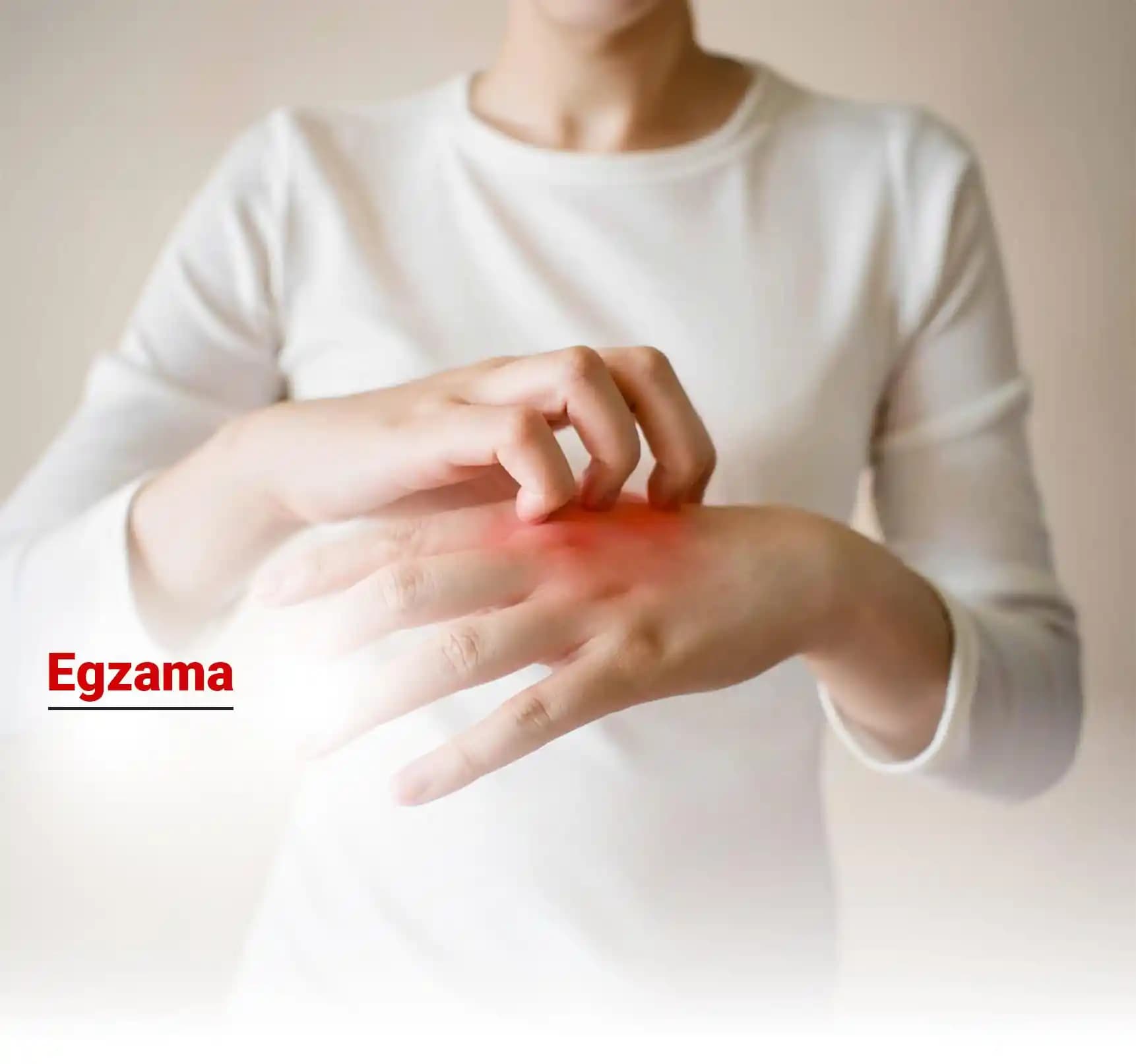 Ateşli Egzama Nedir, Belirtileri ve Kozmetik Ürünlerle Yönetimi Hakkında Bilgi