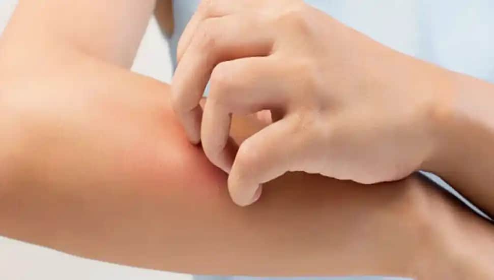 Atopik Cilt Belirtileri, Nedenleri ve Etkili Bakım Yöntemleri Hakkında Kapsamlı Bilgi