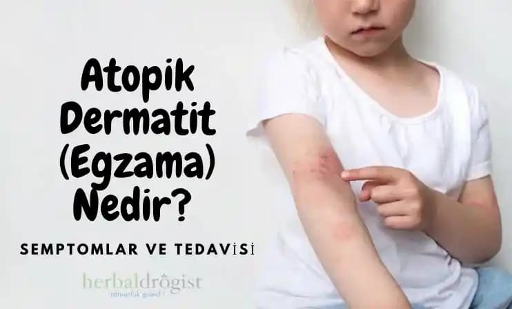 Atopik Cilt Tedavisi Güncel Yaklaşımlar ve Doğal Bakım Seçenekleri