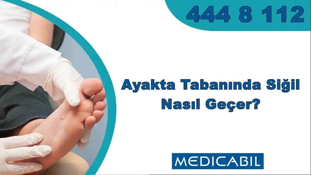 Ayak Altı Sivilceleri Nedenleri, Korunma Yolları ve Etkili Tedavi Seçenekleri