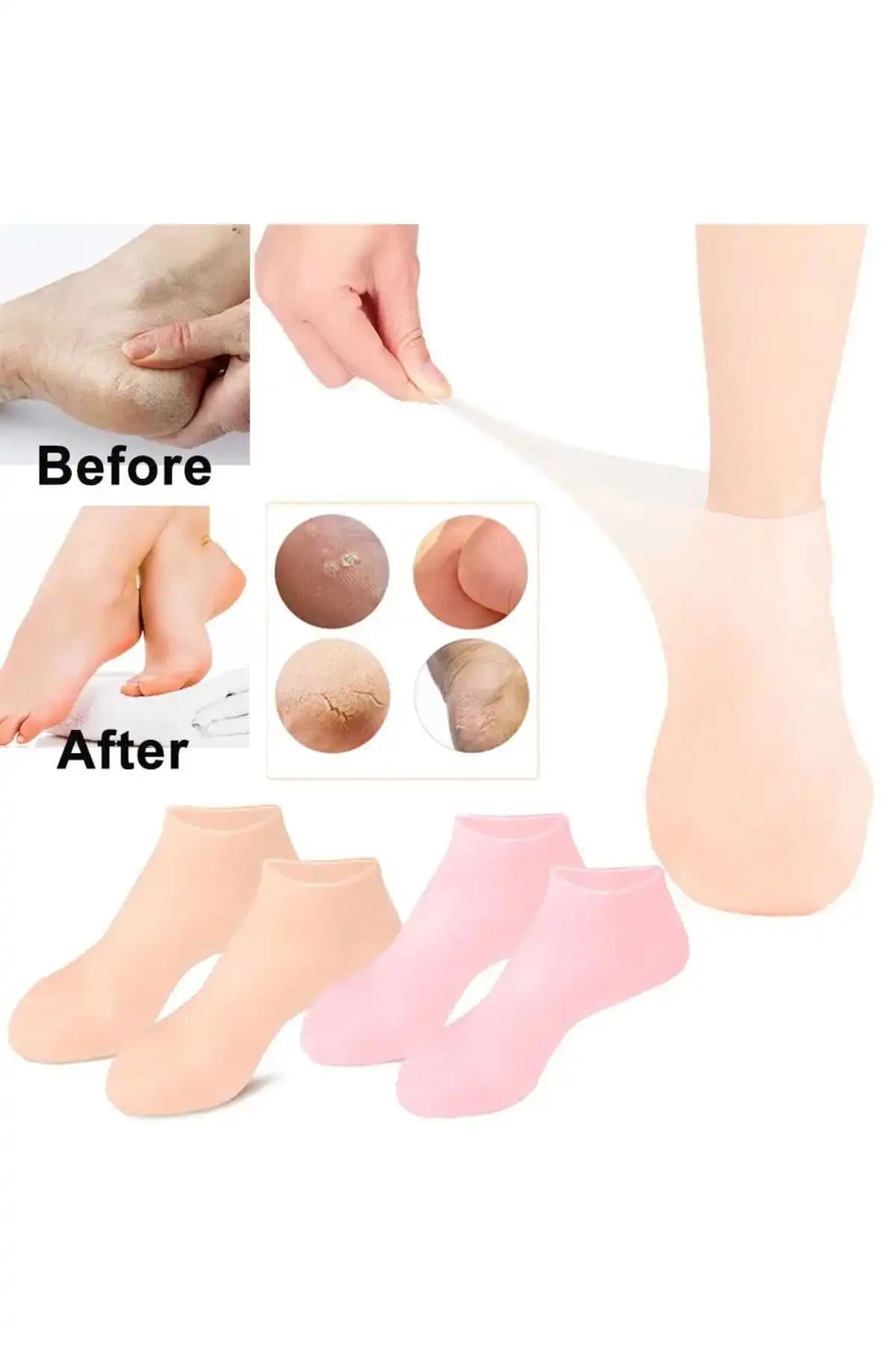 Ayak Bakımında Yenilik: Nemlendirici Çoraplar ile Sağlıklı ve Pürüzsüz Ayaklar