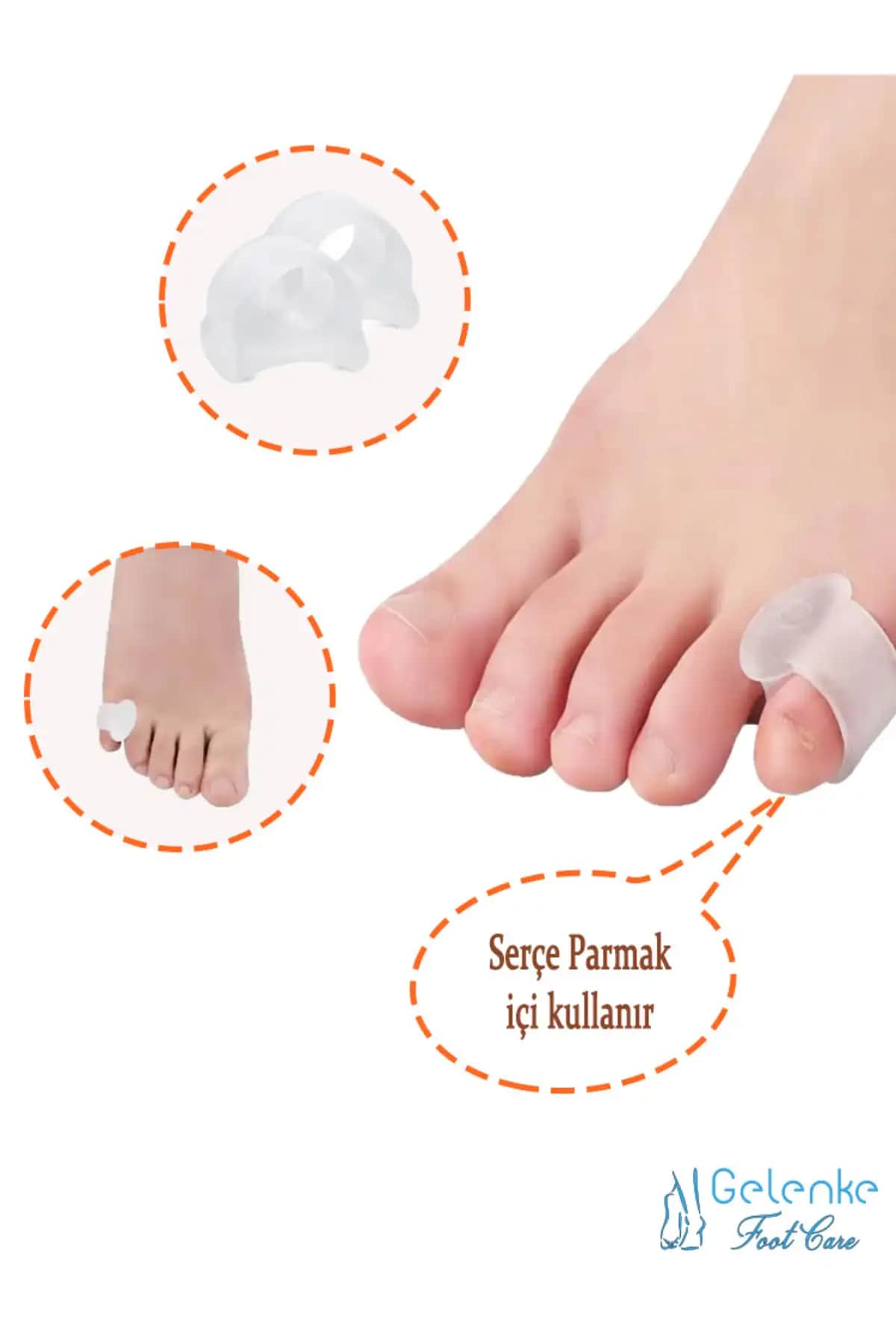 Ayak Parmak Arası Nasırları ve Etkili Çözüm Yolları