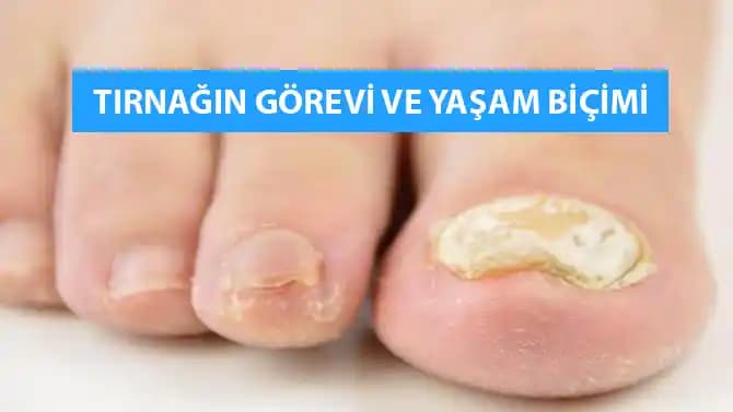 Ayak Tırnağı Kırılması Nedenleri, Belirtileri ve Etkili Bakım Yöntemleri