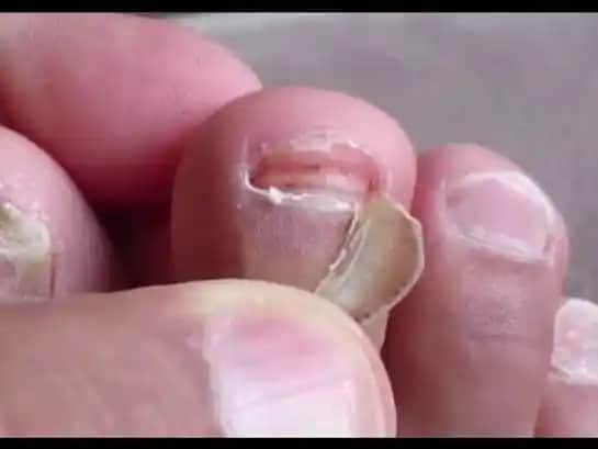 Ayak Tırnaklarının Sağlığı ve Estetiği: Güncel Bakım ve Trendler