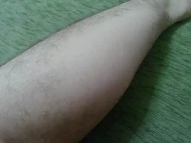 Bacak Kıllarının Dökülme Nedenleri ve Alınabilecek Önlemler Hakkında Kapsamlı Bilgi