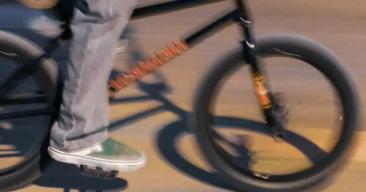 Bacakta Jilet Tahrişi Nedenleri ve Etkili Önleme Yöntemleri Hakkında Kapsamlı Rehber