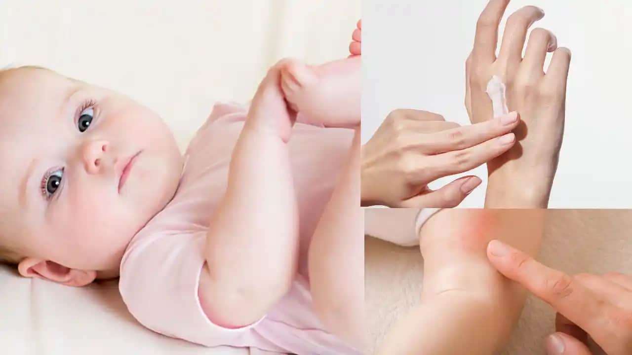 Bebeklerde Pişik ve Mantar Farkları, Belirtileri ve Tedavi Yöntemleri