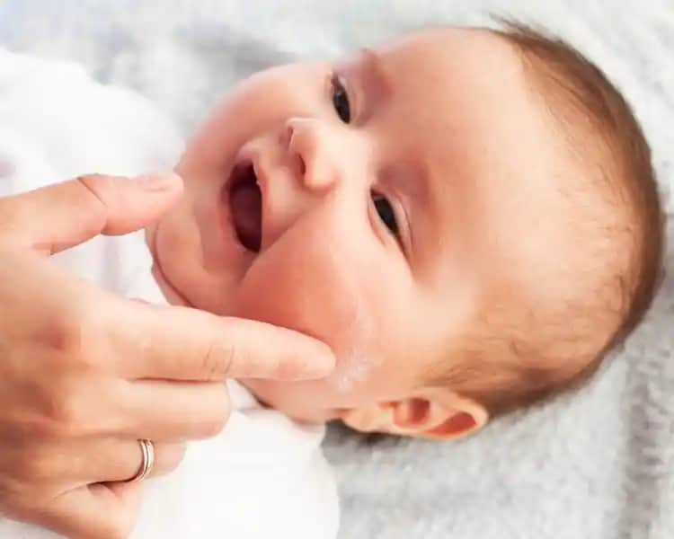 Bebeklerde Saç Egzaması Nedenleri Belirtileri ve Etkili Bakım Yöntemleri