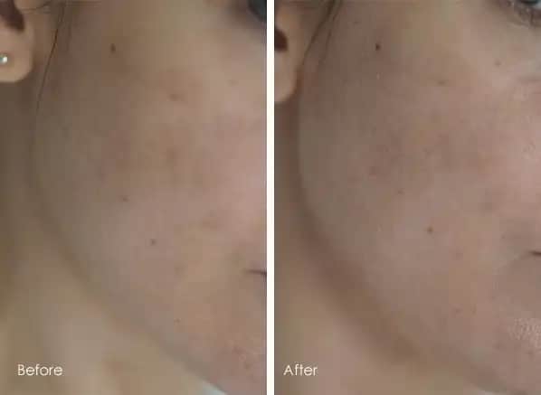 Bioderma PigmentBio Sensitive Areas ile Hassas Bölgelerde Pigmentasyon ve Renk Eşitliği Sağlama