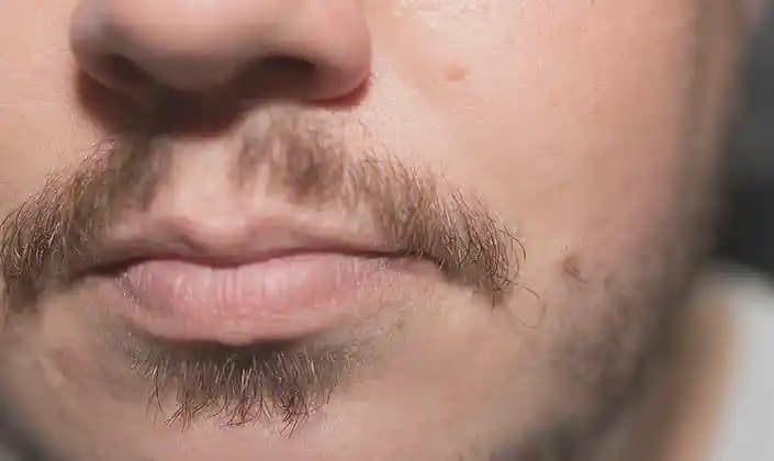 Bıyık Çıkarmak İçin Etkili Doğal Yöntemler ve Bakım Önerileri