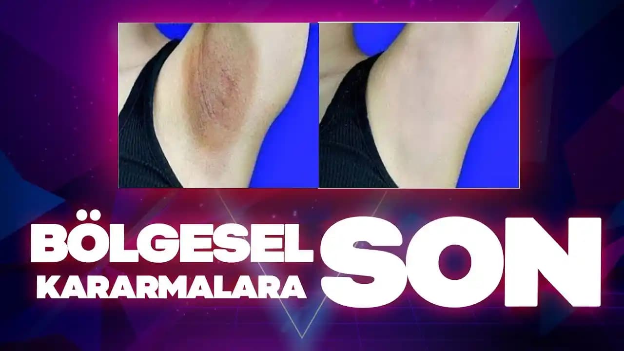 Bölgesel Kararma Nedenleri ve Etkili Çözüm Yolları Hakkında Detaylı Bilgi