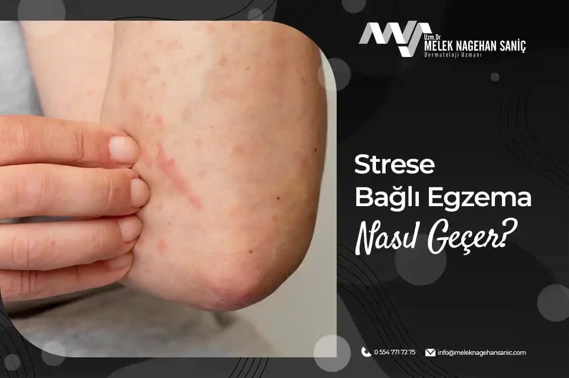 Boyun Egzamasında Stresin Rolü ve Etkili Çözüm Yolları Hakkında Kapsamlı Bilgi