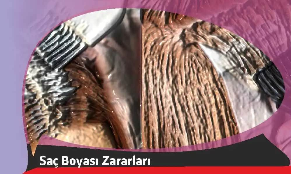 Bozuk Saç Boyalarının Zararları ve Saç Sağlığını Koruma Yöntemleri