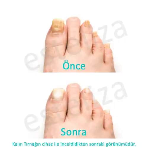 Bursa Tırnak Uygulamaları ve Trendleriyle Güzellikte Yeni Dönem