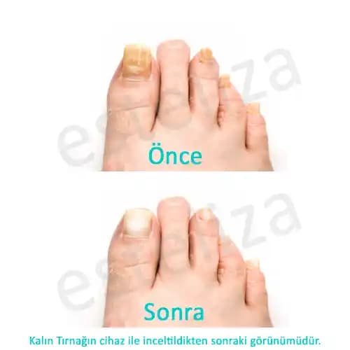 Bursa Tırnak Uygulamaları ve Trendleriyle Güzellikte Yeni Dönem