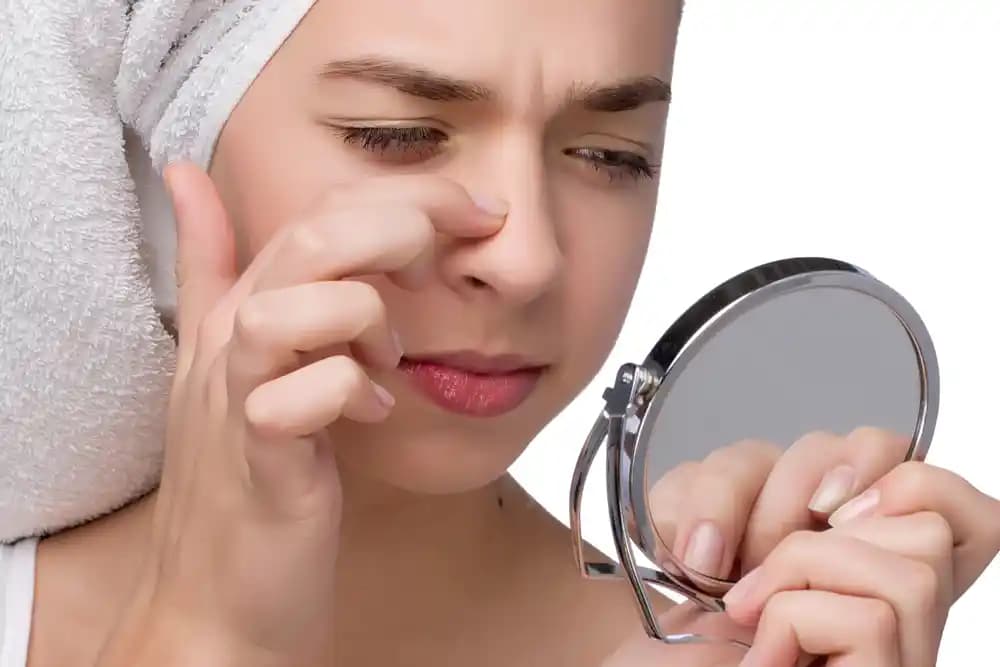 Burun Çevresinde Sivilce Nedenleri ve Etkili Çözüm Yöntemleri Hakkında Detaylı Bilgi