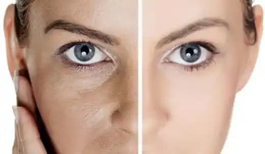 Burun Üstündeki Genişlemiş Gözenekleri Kapatmanın Etkili Yöntemleri ve Cilt Bakım İpuçları