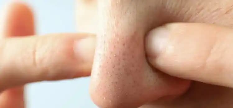 Burundaki Siyah Noktalarla Mücadelede Bilinçli Bakım ve Etkili Çözümler