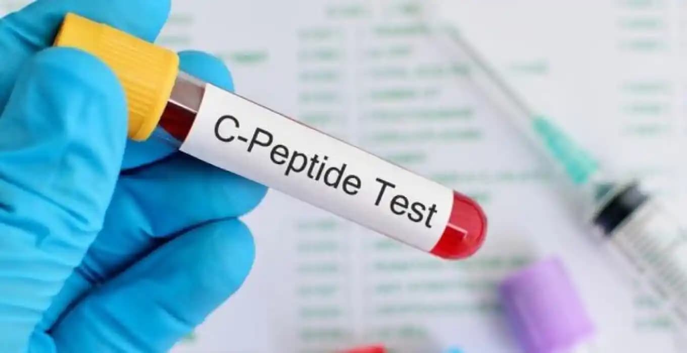 C Peptit Nedir, Seviyeleri ve Diyabet Tanısında Kullanımı Hakkında Bilgi