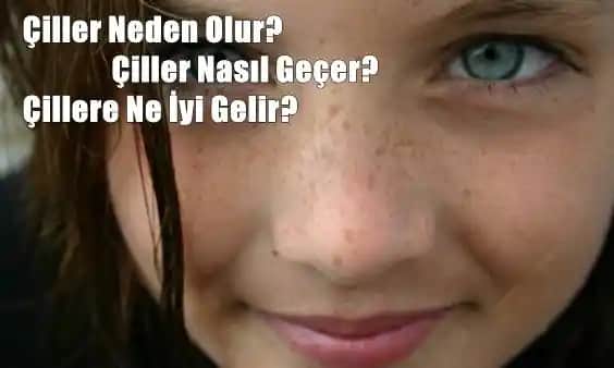 Çiller Neden Oluşur ve Güneş Koruma ile Cilt Sağlığını Nasıl Koruyabiliriz