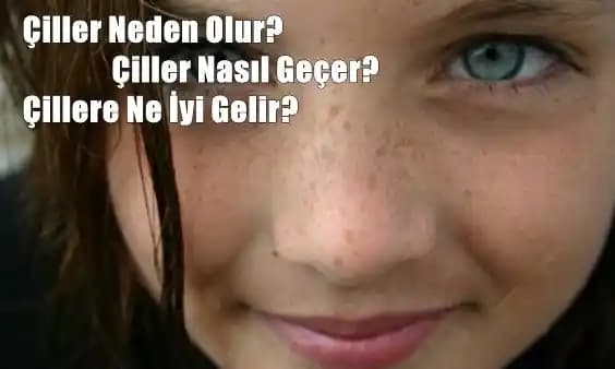 Çiller Neden Oluşur ve Güneş Koruma ile Cilt Sağlığını Nasıl Koruyabiliriz