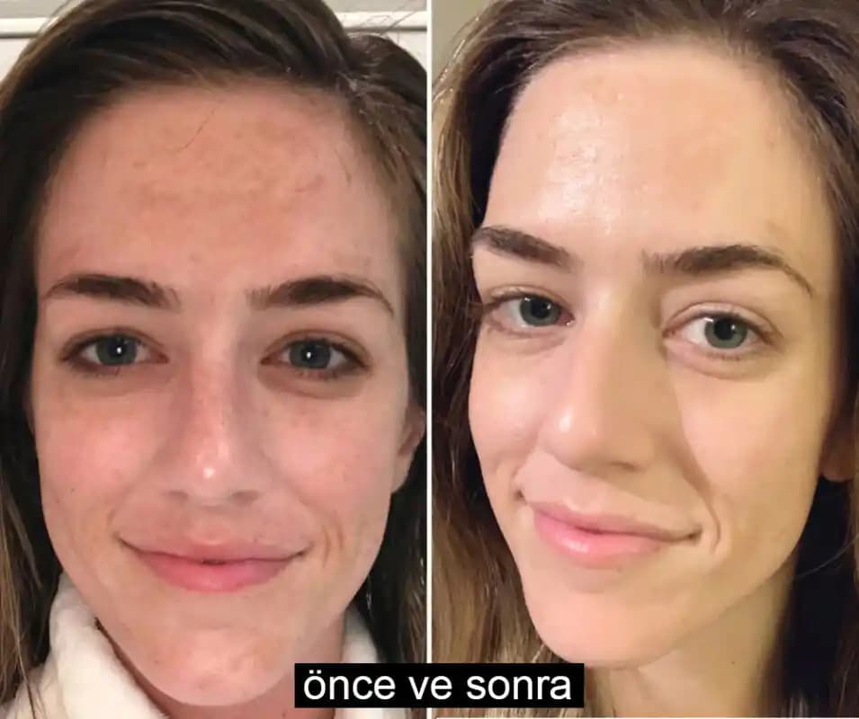 Cilt Bakımı Öncesi ve Sonrası Doğru Uygulamalarla Sağlıklı ve Parlak Cilt