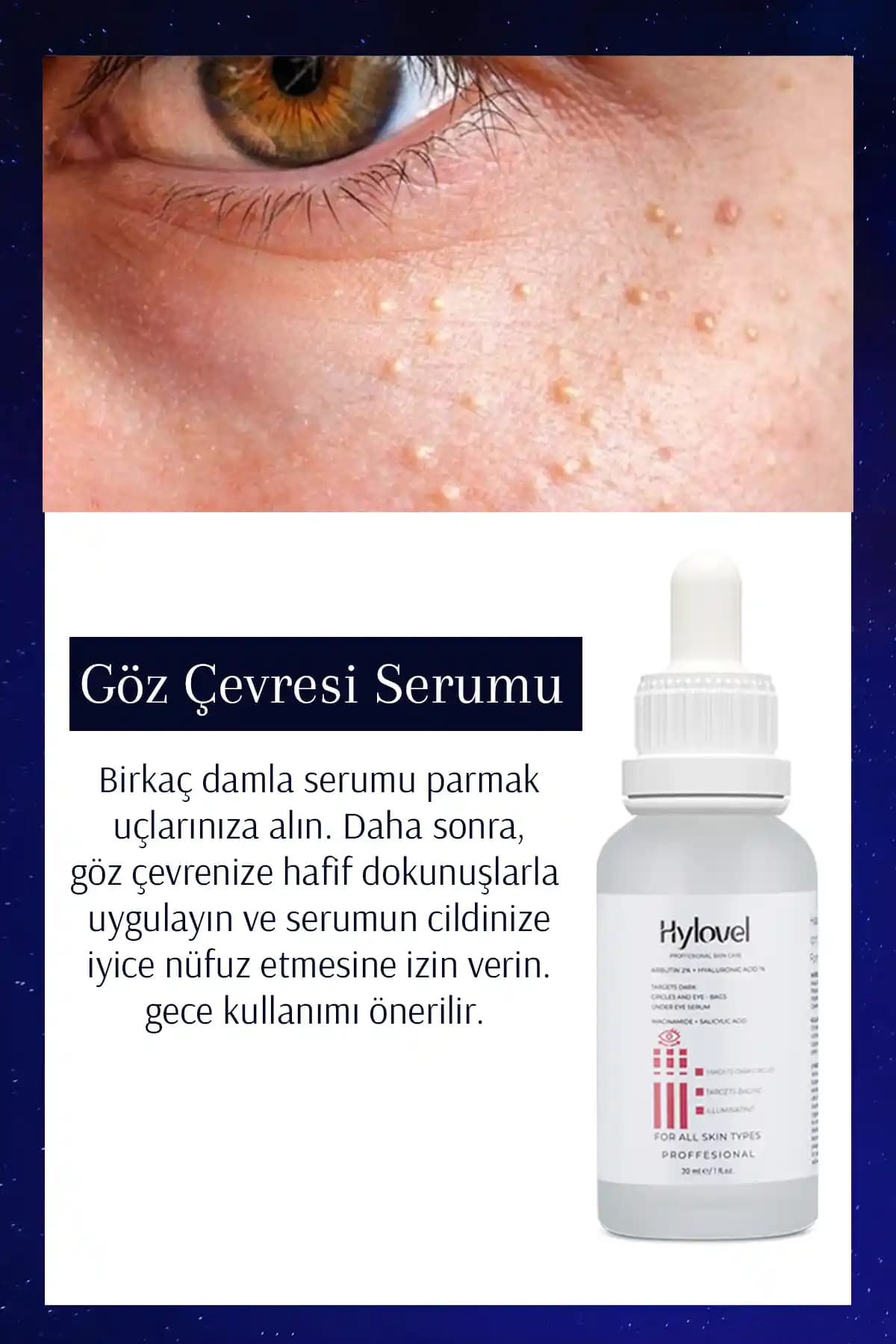 Cilt Bakımında Komedon Temizliği: Sağlıklı ve Parlayan Bir Cilt İçin Rehber